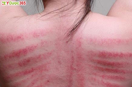 LM Giuse Hoàng Minh Thắng, CẠO GIÓ